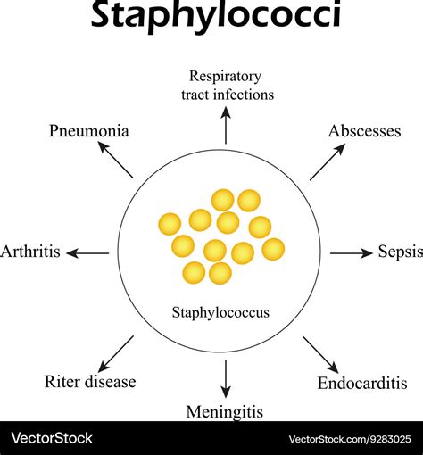 Staphylococci staphylococcus aureus causes Vector Image