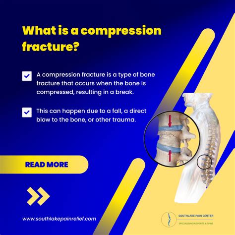 Compression Fracture Symptoms And Treatment in Southlake, TX – South Lake Pain Center – Pain ...