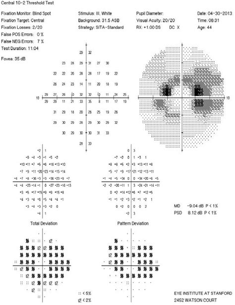 Plaquenil Toxicity - Retina Image Bank