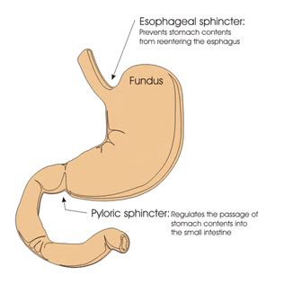 Dumping Syndrome and Living with a Gastrectomy - The Life Raft Group