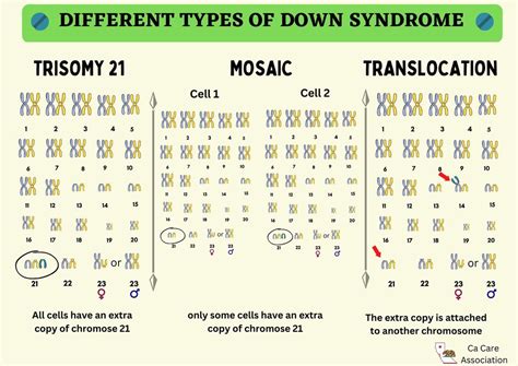 A Caregiver's Guide to Down Syndrome — Ca Care Association