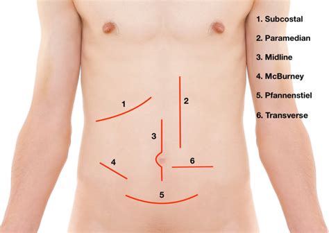 Langer’s Lines and Surgical Incisions - Medical Exam Prep