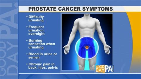 Prostate Cancer Symptoms | Universal Health Products