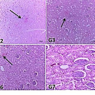 Cross section of caecum at 7 th days post infection of different ...