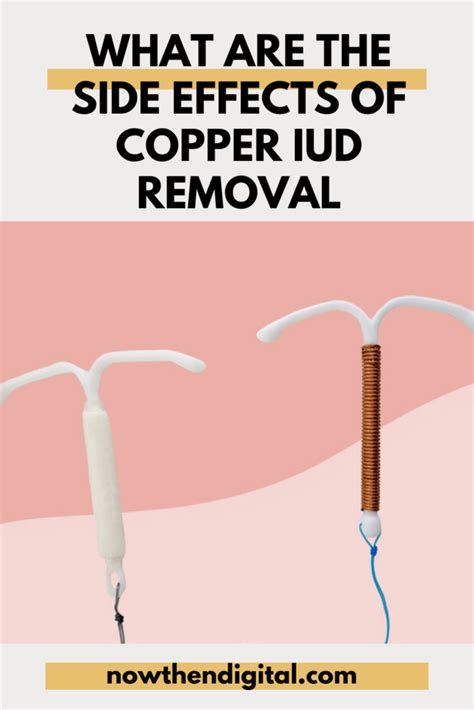 Removal of Copper IUD: When and What to Expect - Now Then Digital