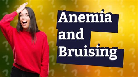 Can anemia cause bruising? - YouTube