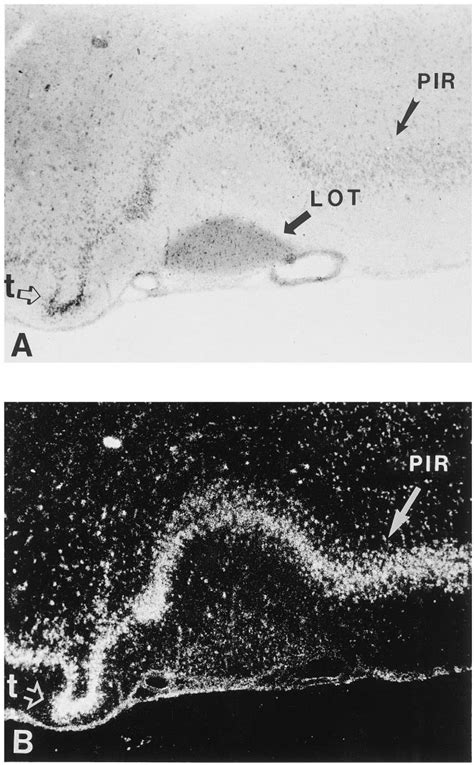 Piriform cortex. Photomicrographs depicting OTR mRNA labeling in the... | Download Scientific ...