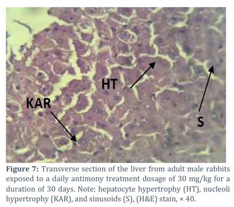 Study of the Teratogenic Effects of Antimony on Liver in the Adult Rabbit (Oryctolagus cuniculus ...