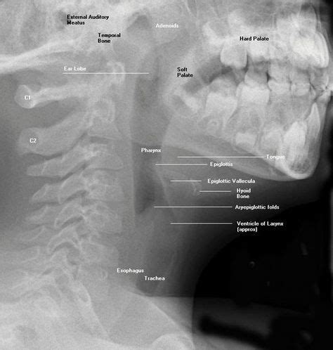 92 Dental Radiography ideas | dental, radiography, dentistry