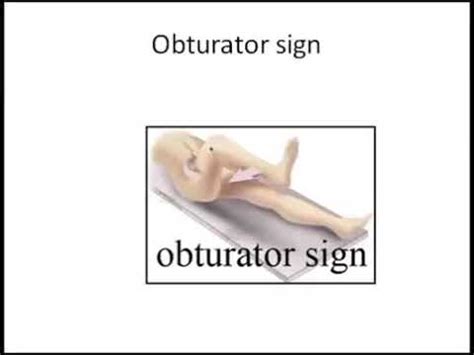 Obturator Sign