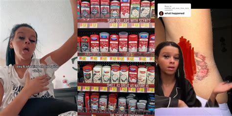 Woman Says Old Spice Deodorant Gave Her Chemical Burns