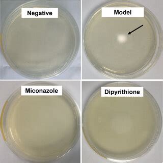 Scurf and hair were inoculated on PDA under 28 °C and cultured for 4... | Download Scientific ...