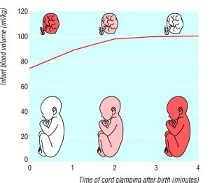 Delayed Cord Clamping | Stemology