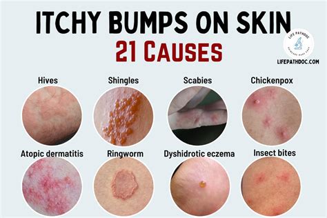 What Causes Small Itchy Bumps On Skin - Printable Templates Free