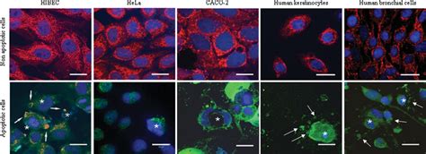 Antimitochondrial Antibody Measurement | Semantic Scholar