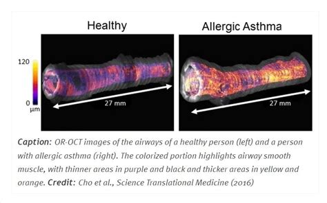 airway-disease – Motherhealth caregivers bayarea