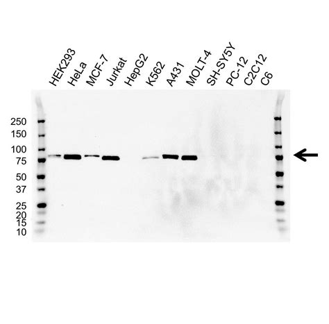 Anti MMP-2 Antibody (PrecisionAb Monoclonal Antibody) | Bio-Rad