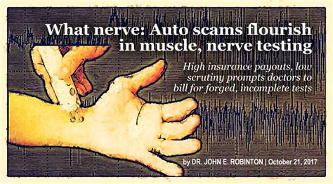 JIFA: What nerve: Auto scams flourish in muscle, nerve testing ...