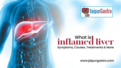 What is inflamed liver - Symptoms, Causes, Treatments & More?