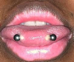 The Dangers of Snake Eyes Piercing ie. Horizontal Tongue Piercing