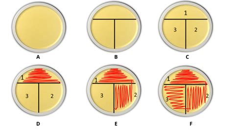 Streak Plate Method Principal and Types - RBR Life Science