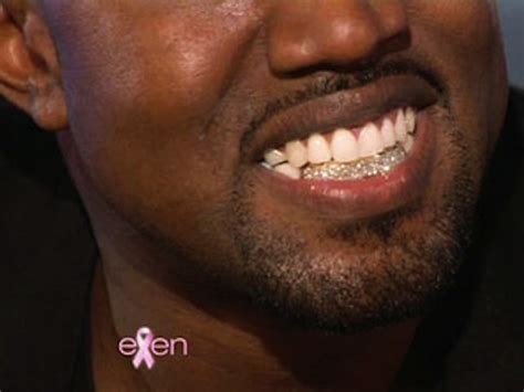 Kanye West Shows Ellen His Diamond Grill | Media Crumbs