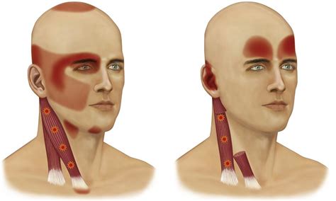 8. Signs and Symptoms of Temporomandibular Disorders | Pocket Dentistry