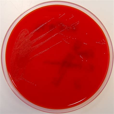 Enterococcus faecium on Columbia Horse Blood Agar - a photo on Flickriver