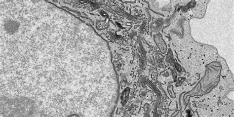 Electron microscopy prices | University of Gothenburg