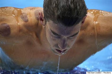 Michael Phelps' 'Cupping' Marks Are Not From Beatings