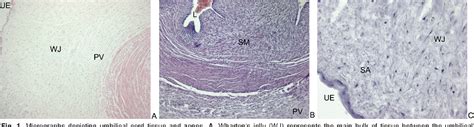 Figure 1 from Umbilical cord revisited: from Wharton's jelly myofibroblasts to mesenchymal stem ...