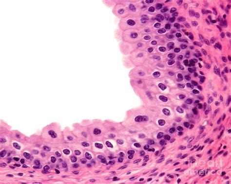 Urinary Bladder Transitional Epithelium #2 Photograph by Jose Calvo / Science Photo Library ...