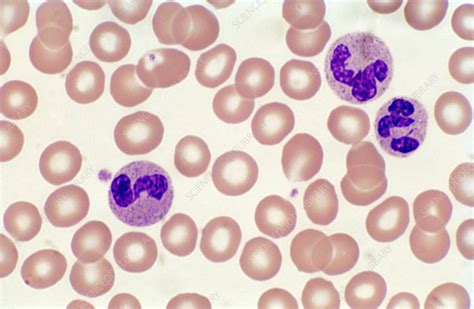 Ppt Normal Red Blood Cells Peripheral Blood Smear Pow - vrogue.co