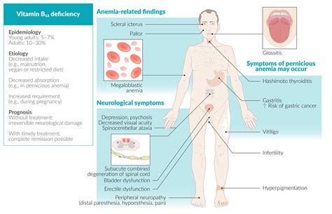 B12 Deficiency Anemia: Symptoms, Causes, And Treatments, 48% OFF