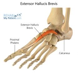 Toe articles | Rehab My Patient