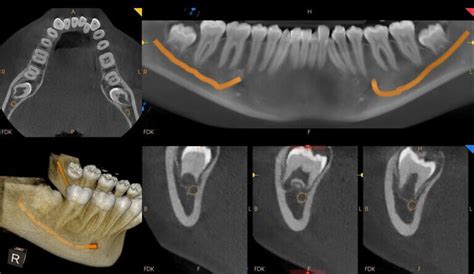 How Much Does A CBCT Scan Cost - Atlas Dental Toronto