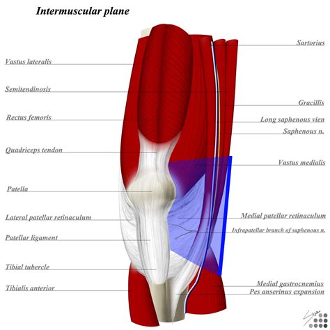 Knee Medial Parapatellar Approach - Approaches - Orthobullets