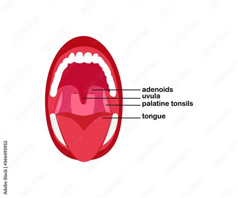 Adenoids Hypertrophy