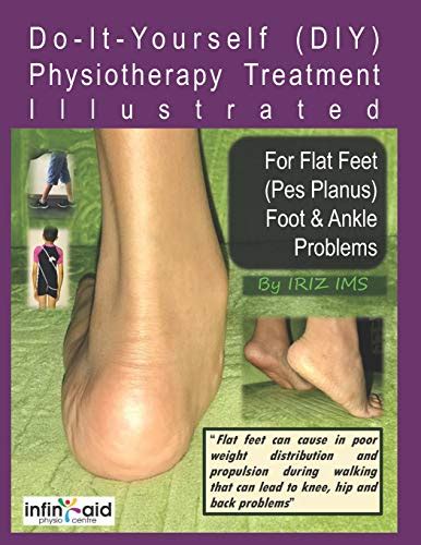 Physiotherapy Treatment Illustrated For Flat Feet (Pes Planus) Foot & Ankle Problems (Iriz_self ...