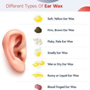 Earwax Types | Different Kinds of Ear Wax