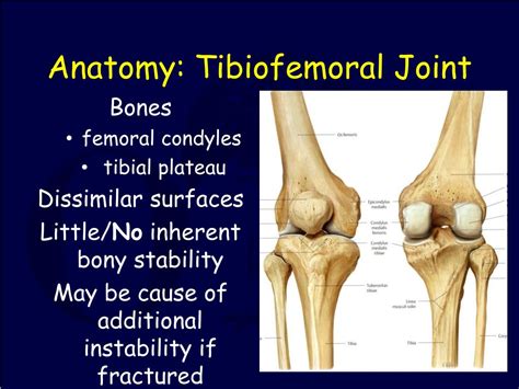 PPT - Knee Dislocation and Multiligamentous Injury PowerPoint Presentation - ID:4623768