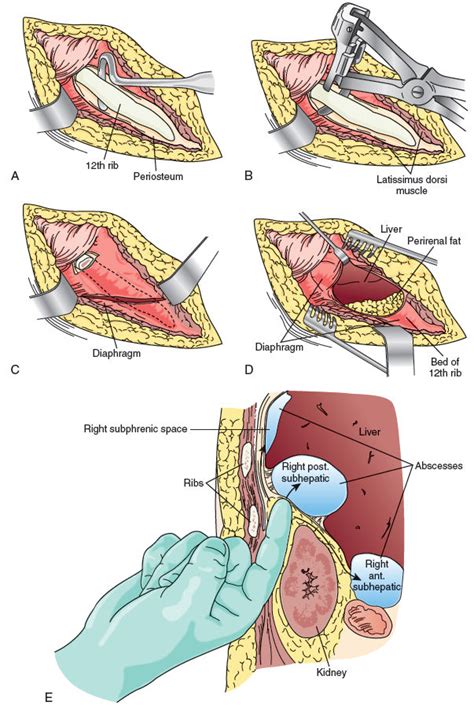 SurgicalCORE | Table/Figure