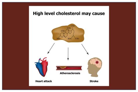 High Cholesterol: Causes, Symptoms, Diagnosis, Treatment