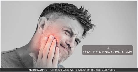 Oral Pyogenic Granuloma - Causes | Diagnosis | Treatment | Prevention