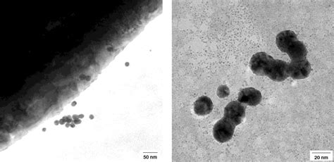 Biodegradation of gold and platinum implants in rats studied by electron microscopy