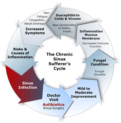 Symptoms & Treatment of Chronic & Fungal Sinusitis