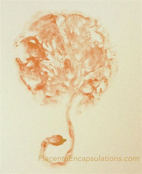 Placenta print | Tree art, Placenta, Placenta encapsulation