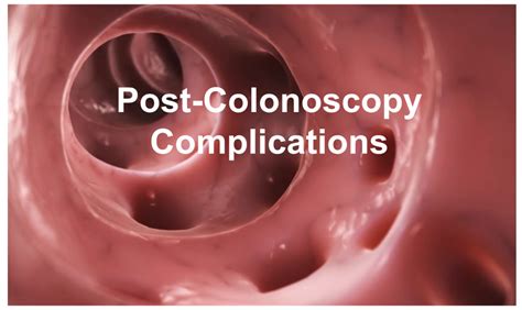 emDOCs.net – Emergency Medicine EducationPost-Colonoscopy Complications ...