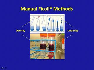 PBMC processing - A Complete Troubleshooting Guide | iNVISIBLE YET ...