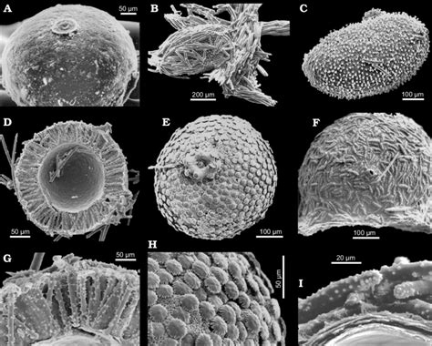 Spongilla Diagram